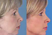 homepage_beforeandafter